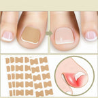 Nail Repair Patch Self Adhesive Nail Care Patch for Damaged Nails