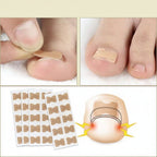 Nail Repair Patch Self Adhesive Nail Care Patch for Damaged Nails